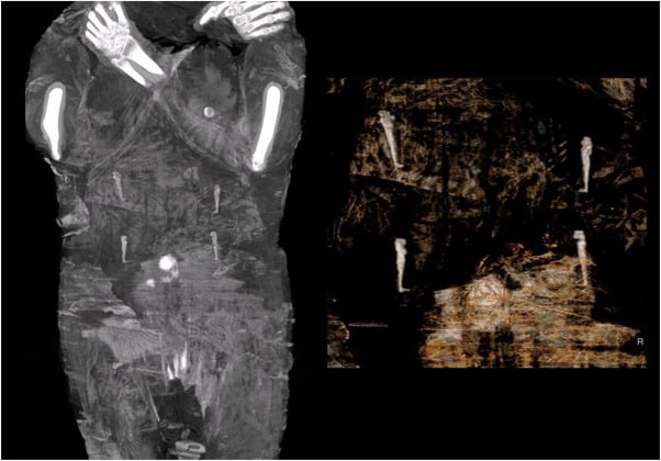Zdjęcie wnętrza mumii w ciąży